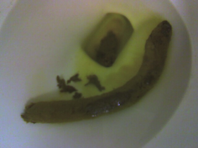 My Biggest Turd Ever My Biggest Turd Ever