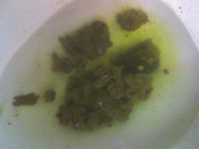 Prompt reply Giant poop in toilet final Consider, that Giant poop in toilet share